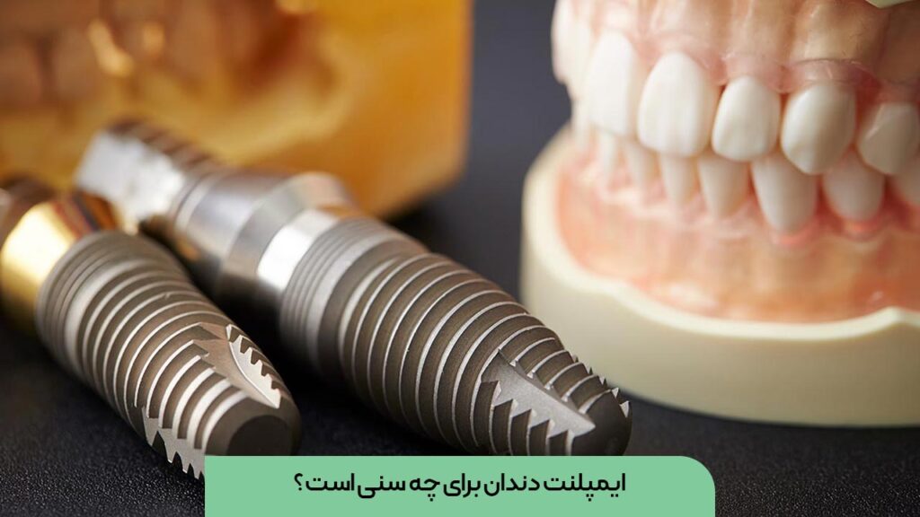 سن مناسب ایمپلنت دندان