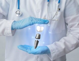 تصویر یک دندانپزشک با نمای دیجیتالی ایمپلنت دندان در دست