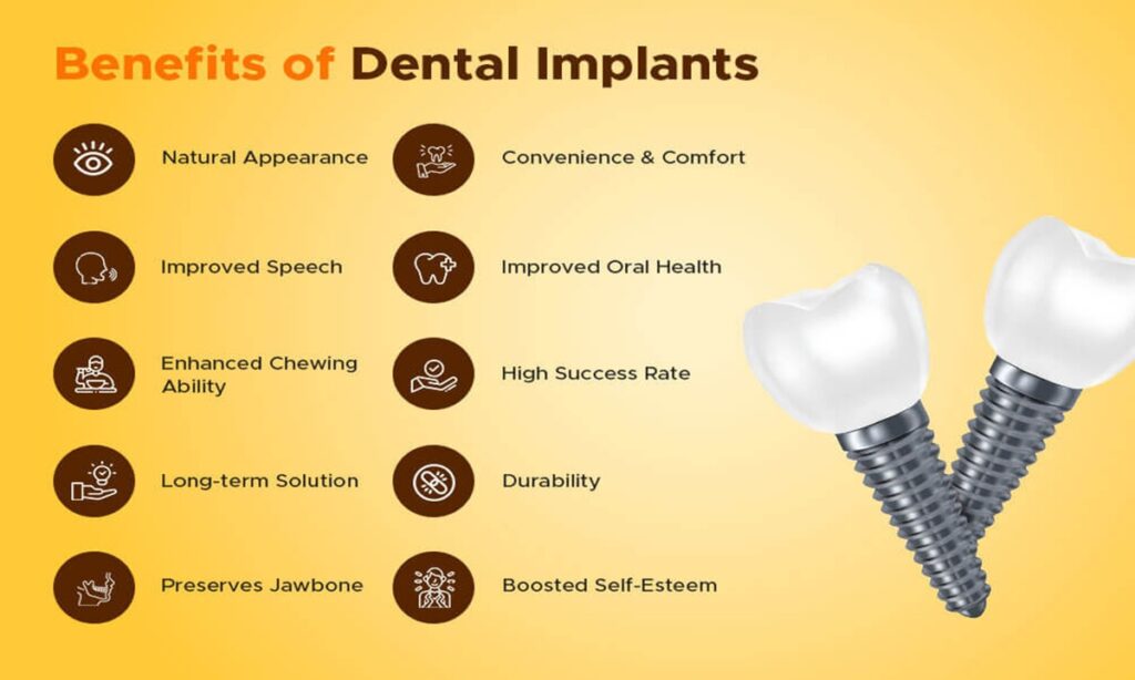 تصویری از فواید ایمپلنت دندان